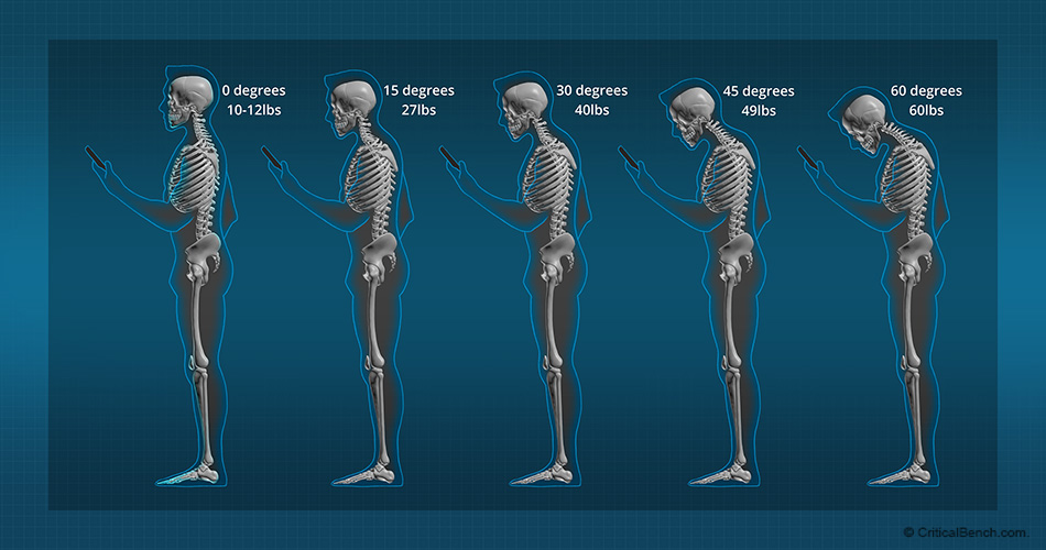 poor-posture-treatment-snyder-chiropractic-wellness